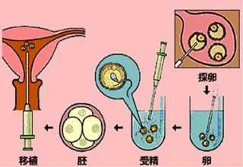 始基子宫和幼稚子宫的区别介绍，详细对比差别很清晰